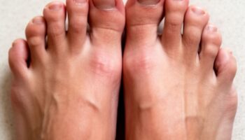 Oczyszczanie stawów i kości wg Michała Tombaka — moje doświadczenia